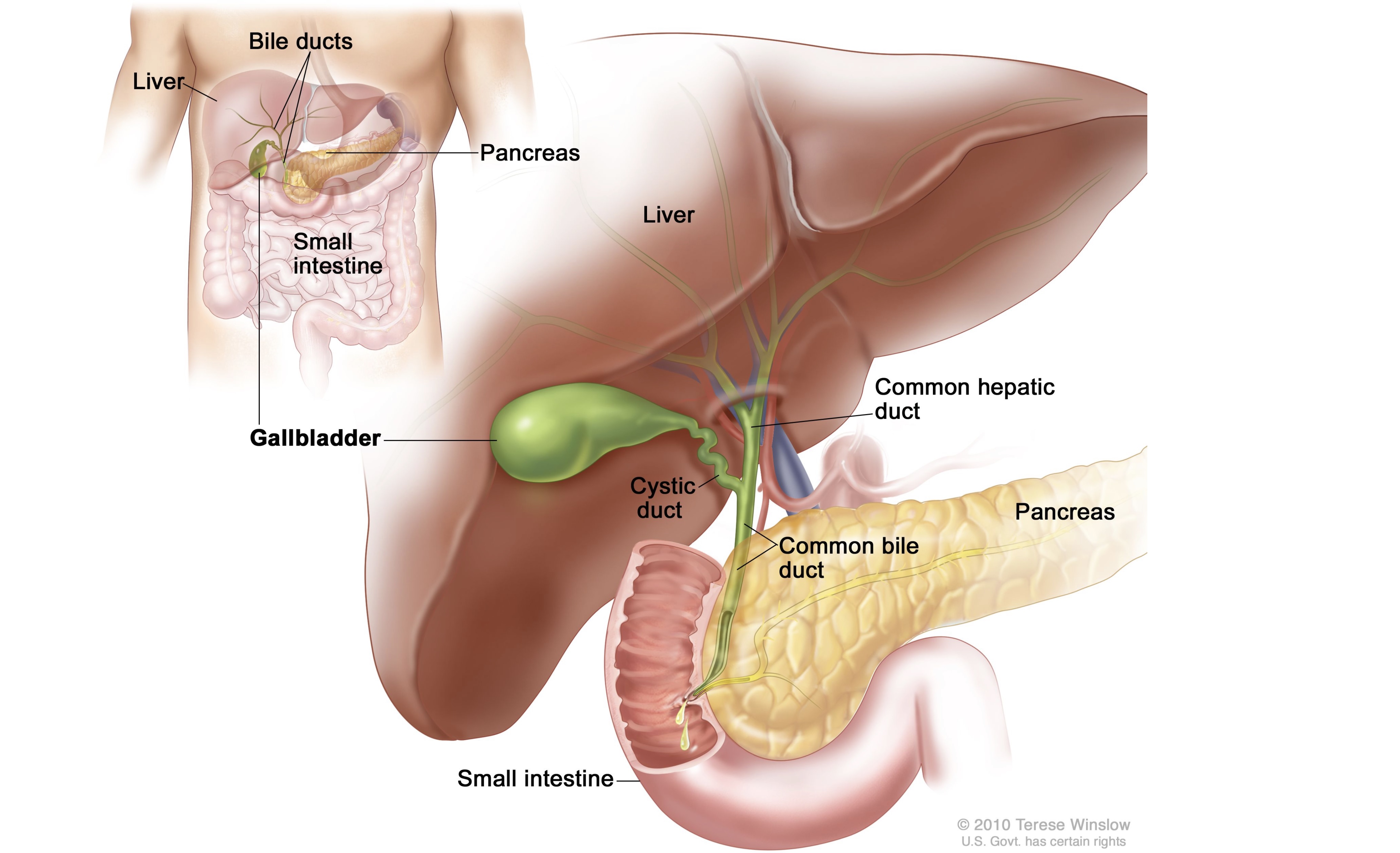 Gallbladder Surgery